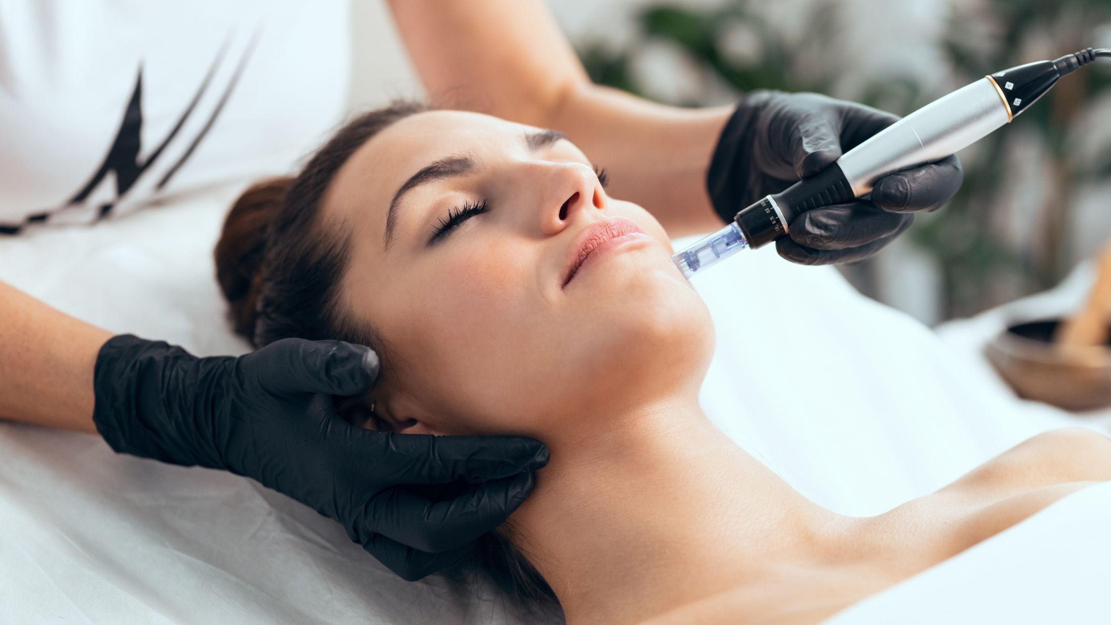 Mehr über den Artikel erfahren Microneedling mit PRP – Effektive Hautverjüngung